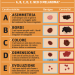 Il principale fattore di rischio per il melanoma è l’esposizione eccessiva e ripetuta ai raggi uv, ma è importante anche monitorare i nei