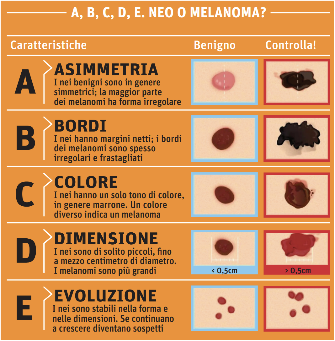 Il principale fattore di rischio per il melanoma è l’esposizione eccessiva e ripetuta ai raggi uv, ma è importante anche monitorare i nei